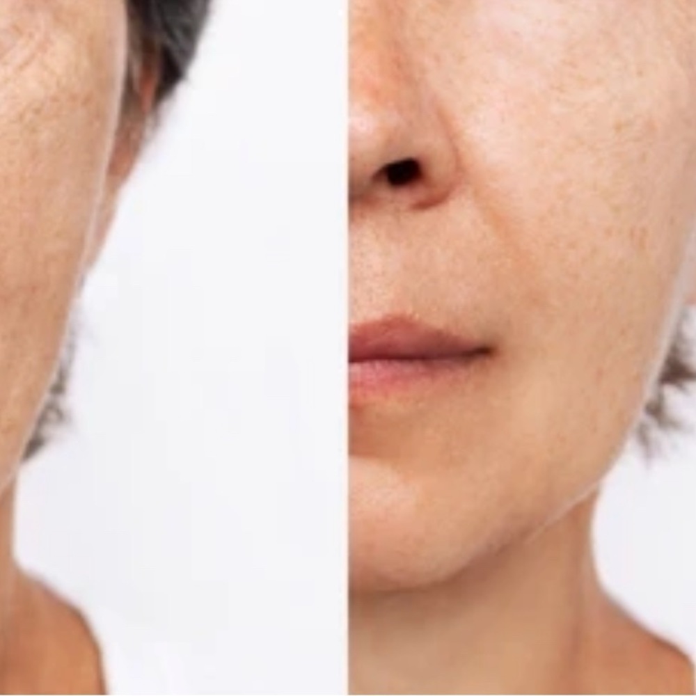 Music to My Face Lactic Acid Skincare Bottle - Picture 4 of 8